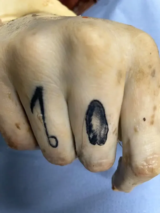 Schwarze Tätowierungen am Ring- und Mittelfinger der rechten Hand eines unbekannten, im Main bei Schweinfurt gefundenen Mannes.